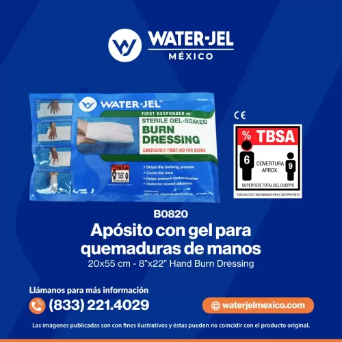 Apósito de mano con gel para quemaduras